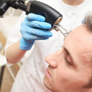 Patient receiving a hair treatment procedure.