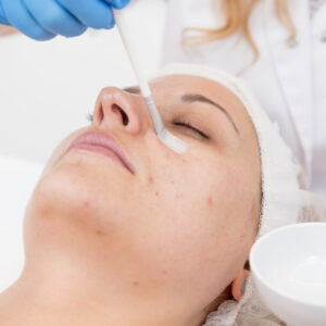 Facial treatment in progress on a woman.